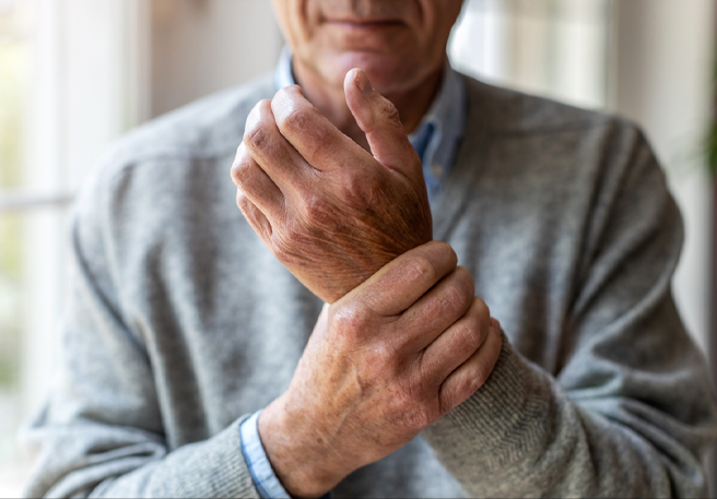 STADA und Alvotech erweitern Therapieoptionen für Patienten in Europa durch die Einfuehrung eines Adalimumab-Biosimilars