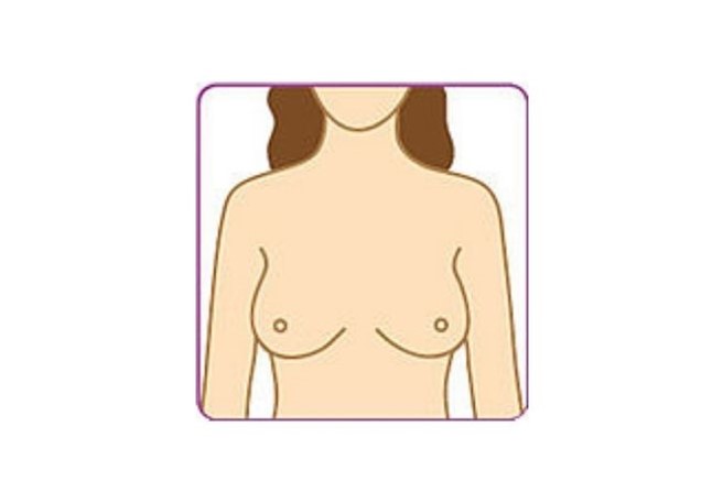 Brust abtasten - 1. Schritt Brust abtasten - 1. Schritt