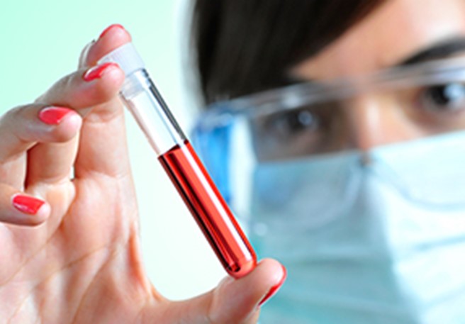 Laboruntersuchungen Laboruntersuchungen