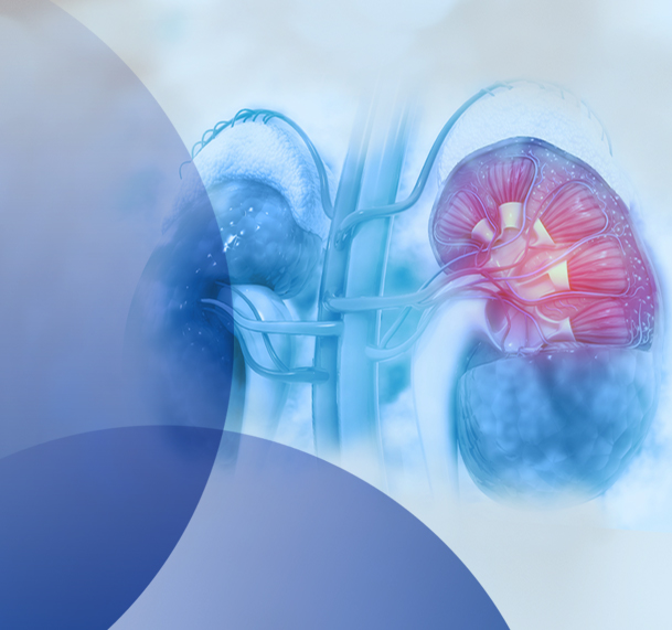 Calliditas Therapeutics und STADA kooperieren bei der Zulassung und Vermarktung der Spezialtherapie fuer IgA-Nephropathie in Europa